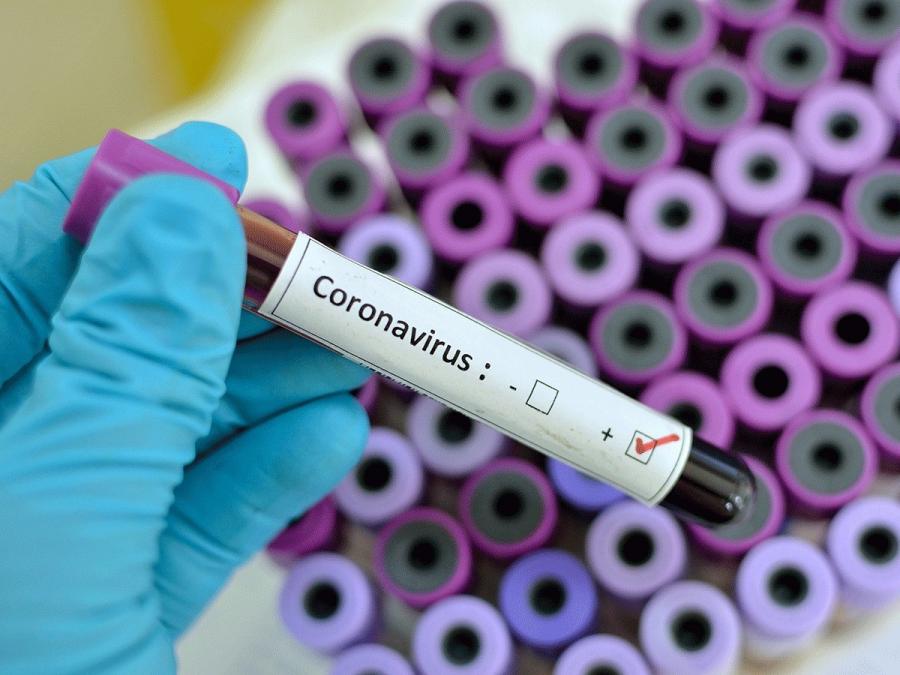 Ermənistan millisinin üzvü də koronavirusa yoluxdu
