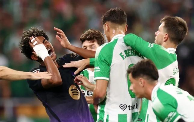 Yamalın üzünə kəllə vuran futbolçu cəzalandırıldı