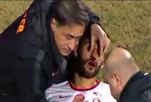 "Qalatasaray" futbolçusunun burnu qırıldı (FOTO)
